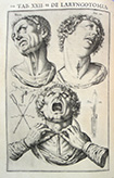 Casserio