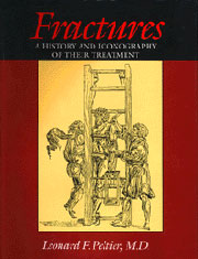 Fractures: A History and Iconography of Their Treatment by Leonard F. Peltier, M.D.